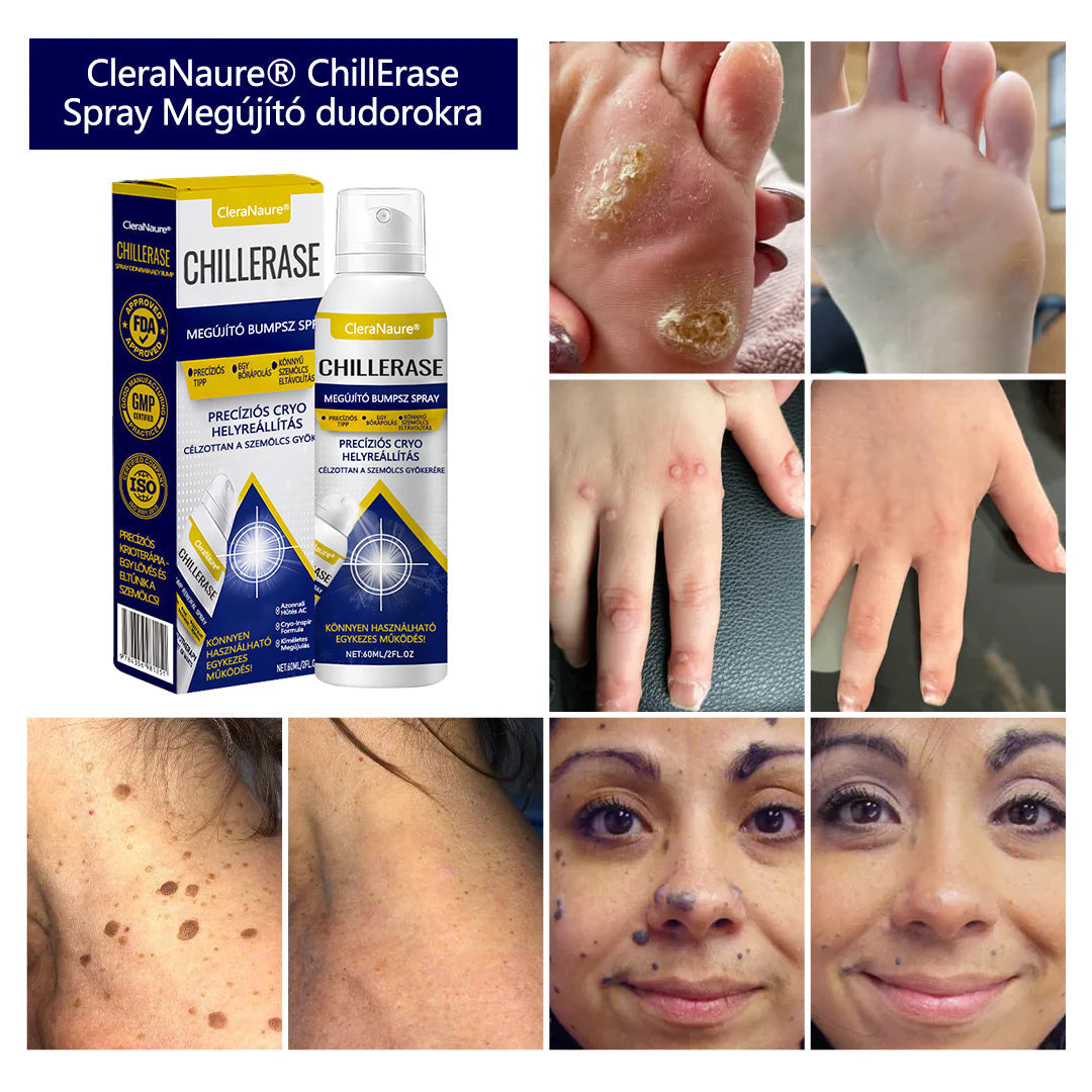 CleraNaure® ChillErase dudorjavító spray