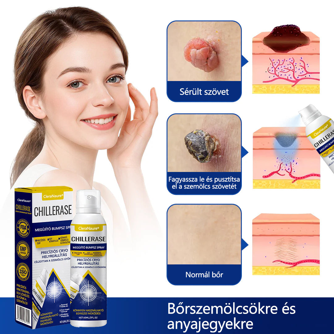 CleraNaure® ChillErase dudorjavító spray
