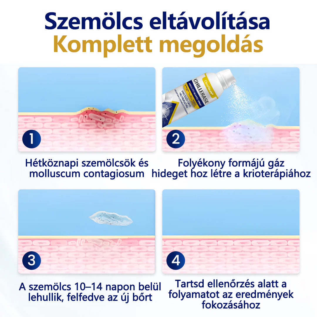 CleraNaure® ChillErase dudorjavító spray