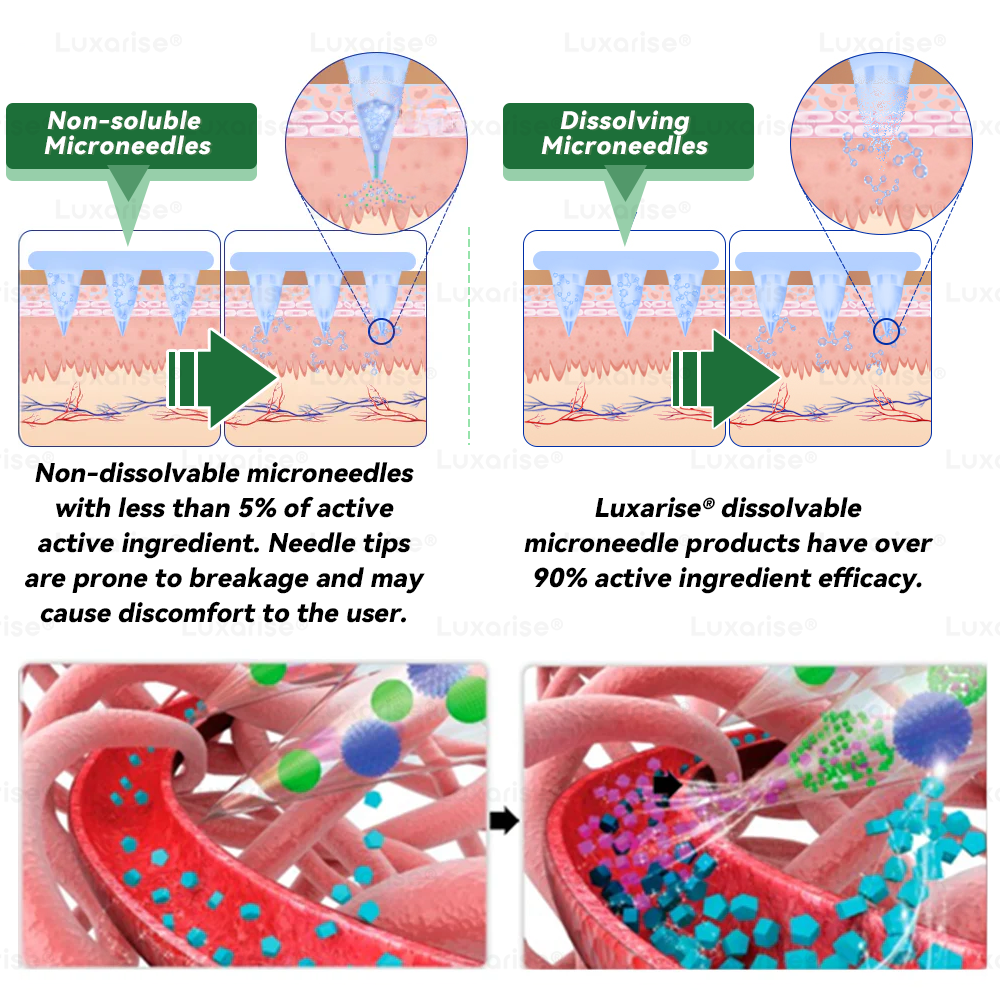 Hivatalos áruház | Luxarise® Moringa és Berberin 10 az 1-ben fejlett nanomikrotűs tapasz 📦 (naponta egyszer, 7 nap után látható változások) Ízületi problémák Elhízás, cukorbetegség, alvási apnoe és