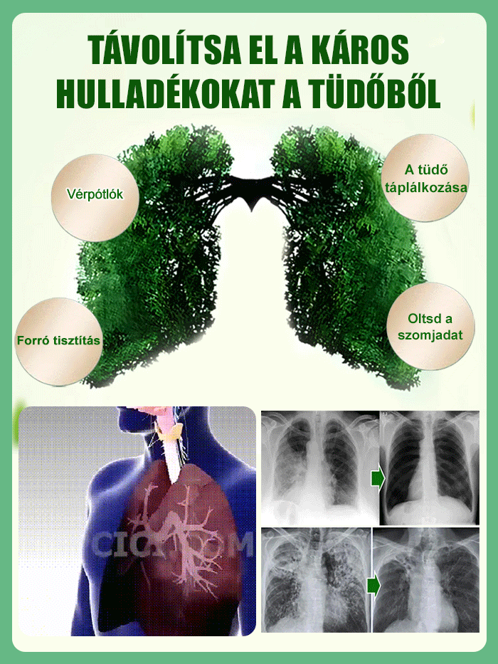 【Szárazságtűrő mérgekirály】Platina-gyémánt-zöld hercegnő nagy levelű cserepes növény