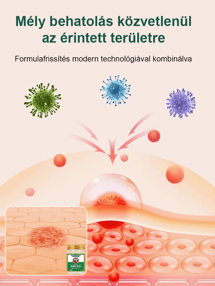 Miaojiang százfű viszketésgátló és antibakteriális kenőcs