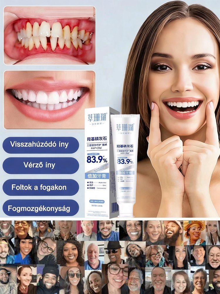 【Fogközt kitöltő】 hidroxiapatit fogkrém