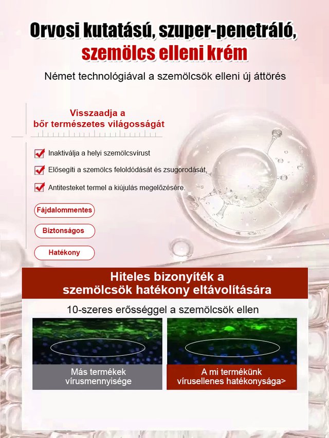 【Egy másodperces szemölcseltávolító】Szemölcseltávolító krém