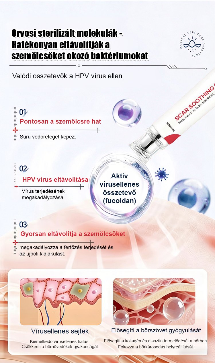 【Egy másodperces szemölcseltávolító】Szemölcseltávolító krém