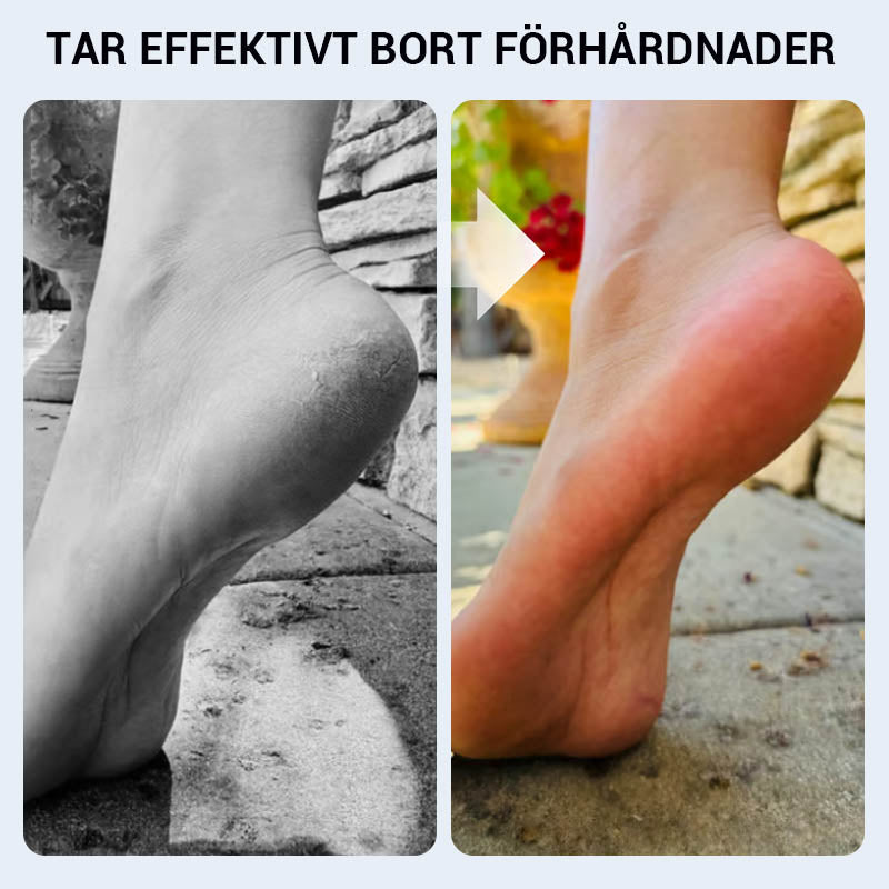 🔥 ﻿Praktikus kézi bőrkeményedés eltávolító a lábfejhez🦶🏻